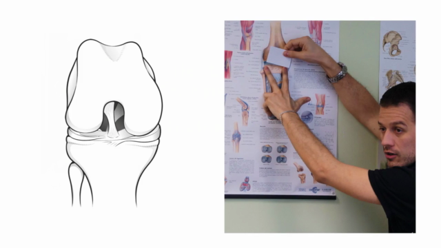 The stiff knee after injury or surgery - how to manage it – Screenshot 2