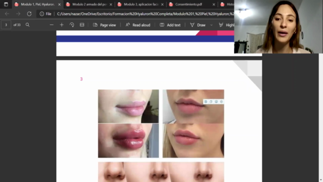 Hyaluron Pen- Aplicación Full Face - Experta en Labios – Screenshot 3