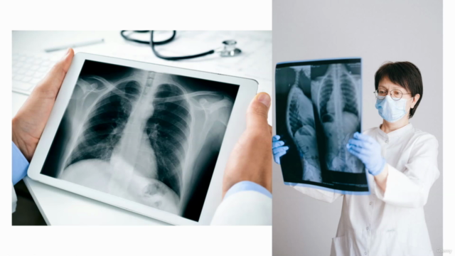 Data Science: CNN & OpenCV : Chest XRAY-Pneumonia Detection – Screenshot 1