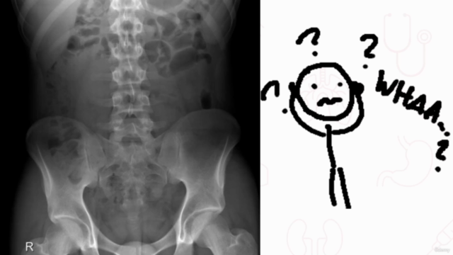 Abdominal X-ray Interpretation – Screenshot 2