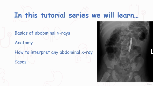 Abdominal X-ray Interpretation – Screenshot 4