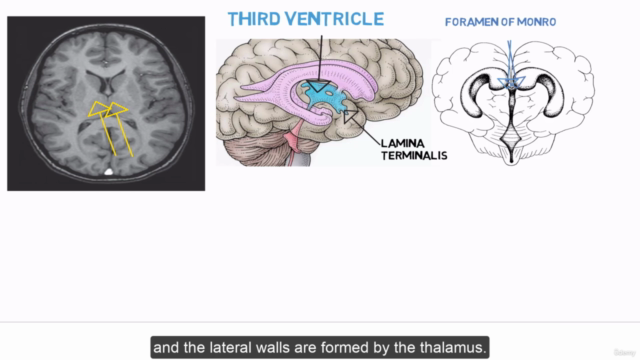 Brain anatomy – Screenshot 2