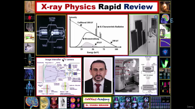 X-Ray rapid Review - Tips & Tricks – Screenshot 1