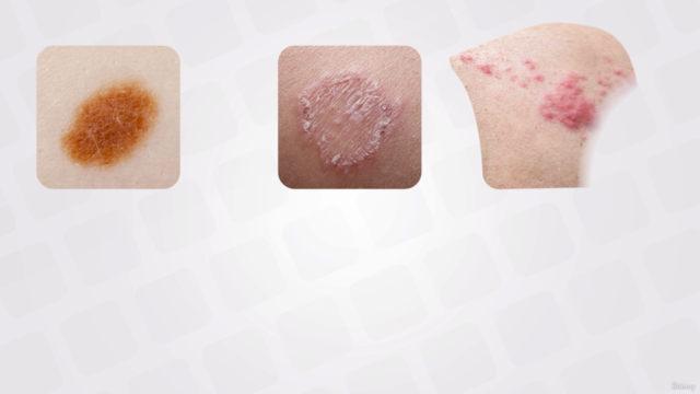 Dermatology - Systematic Breakdown To Master Dermatology – Screenshot 1