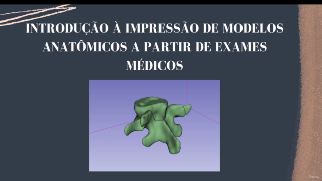 Impressão 3D com Ressonância Magnética e Tomografia – Screenshot 1