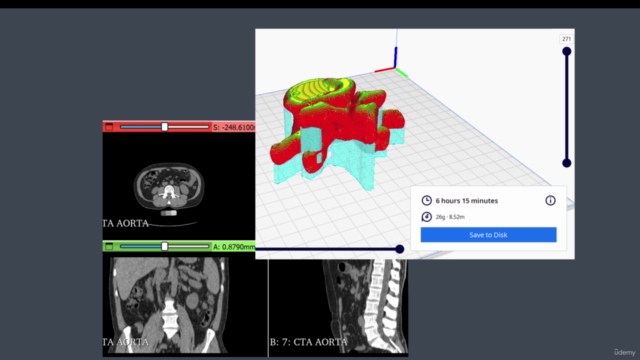 Impressão 3D com Ressonância Magnética e Tomografia – Screenshot 4