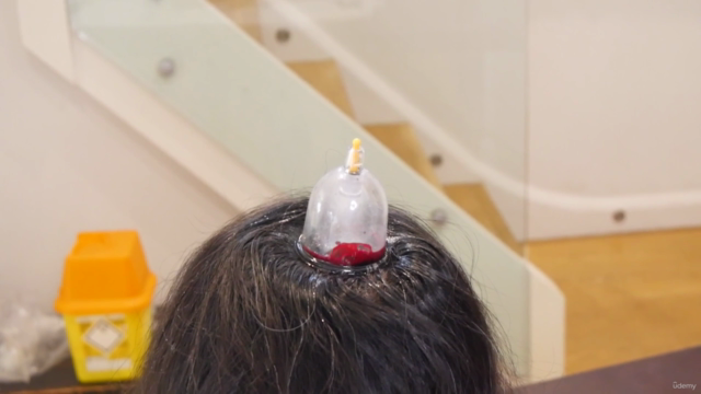 Professional Hijama and dry cupping therapy course – Screenshot 3