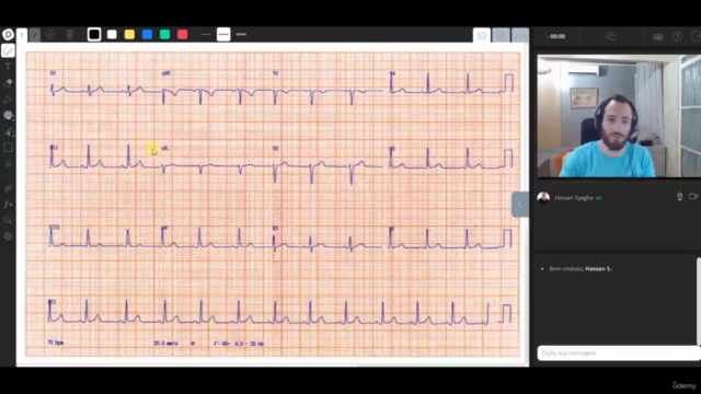 Curso de eletrocardiograma : teoria e prática - Screenshot_02
