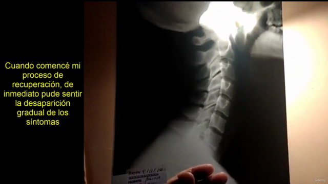 Rectificación Cervical Protrusiones Hernias o Cervicalgia – Screenshot 2