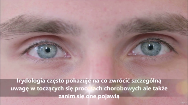 Podstawy Irydologii – Screenshot 4