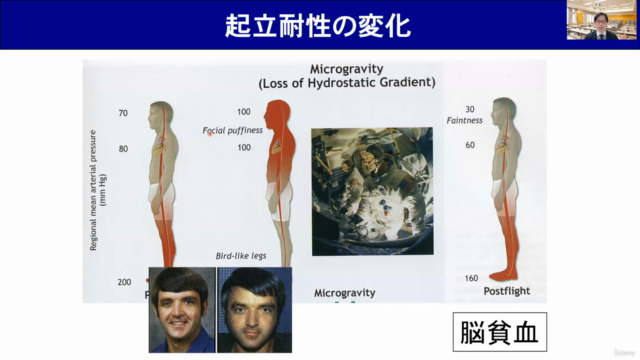 【宇宙滞在に向けて】無重力はカラダに対してどれだけ過酷?(入院患者との比較/入門講座) – Screenshot 4