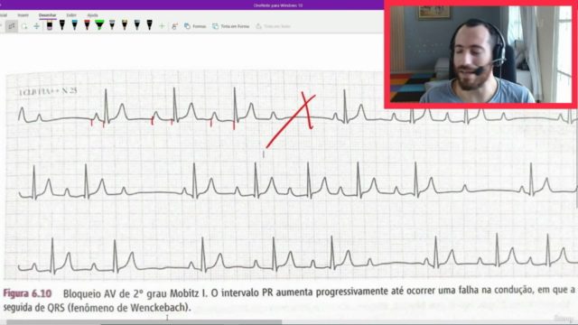 Curso de eletrocardiograma 2.0 , as principais alterações – Screenshot 1