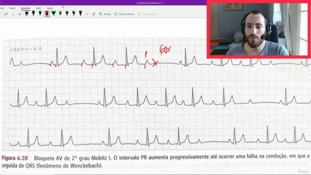 Curso de eletrocardiograma 2.0 , as principais alterações – Screenshot 3