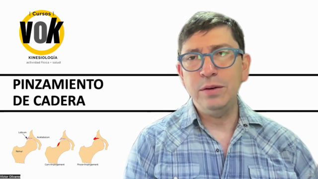 Pinzamiento de Cadera: Mitos, Realidades y Propuesta clínica – Screenshot 1