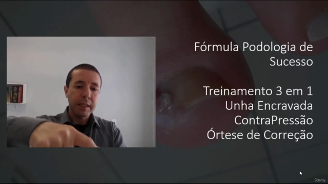 Como Desencravar Unhas , Órtese e Técnica de Contra Pressão – Screenshot 1
