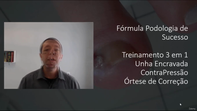 Como Desencravar Unhas , Órtese e Técnica de Contra Pressão – Screenshot 4