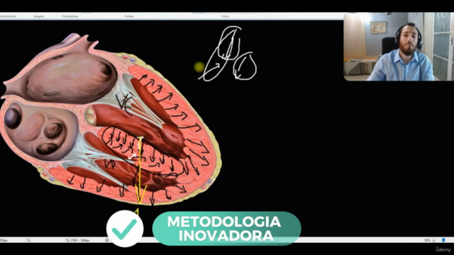 Eletrocardiograma em 3 PASSOS - Ler, Interpretar e CONDUZIR – Screenshot 1