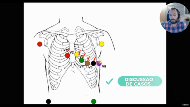 Eletrocardiograma em 3 PASSOS - Ler, Interpretar e CONDUZIR – Screenshot 4