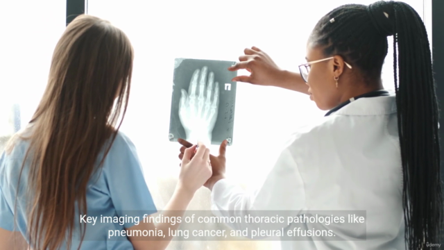 Master Chest X-Rays interpretation Certificate course – Screenshot 2