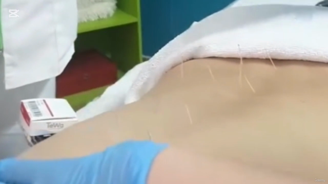 Curso completo de Hijama Terapeutica : – Screenshot 1