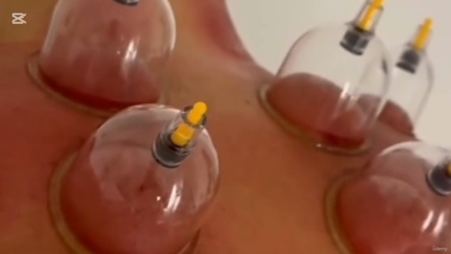 Curso completo de Hijama Terapeutica : – Screenshot 4