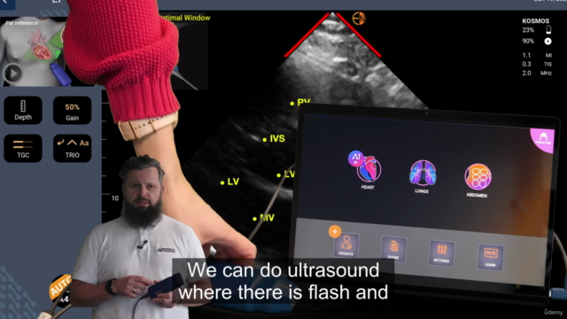 USG POCUS w Praktyce Lekarza – Screenshot 2