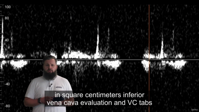 USG POCUS w Praktyce Lekarza – Screenshot 4