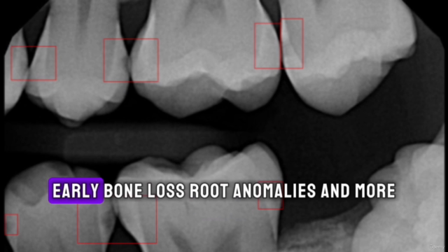 Dental Radiography Interpretation & Diagnosis Course – Screenshot 2