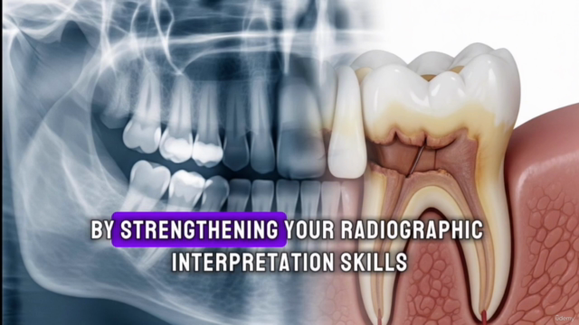 Dental Radiography Interpretation & Diagnosis Course – Screenshot 3
