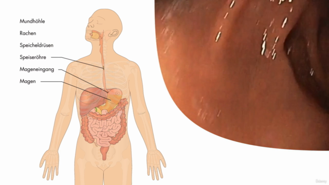 Anatomie, Physiologie & Pathologie des Verdauungssystems – Screenshot 4