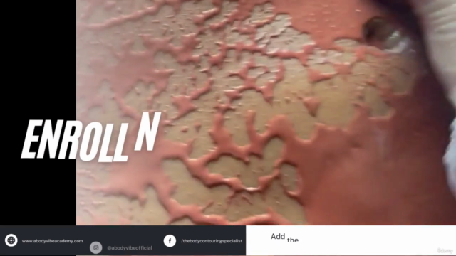 Body Ice Sculpting – Screenshot 4