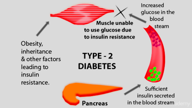 Chi Kung (Qigong) for Diabetes – Screenshot 2
